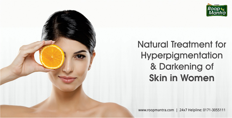 Natural-Treatment-For-Hyperpigmentation-And-Darkening-Of-Skin-In-Women