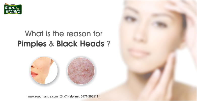 What-Is-The-Reason-For-Pimples-And-Black-Heads
