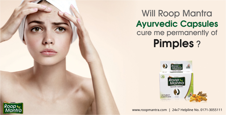 Will-Roop-Mantra-ayurvedic-capsules-cure-me-permanently-of-pimples