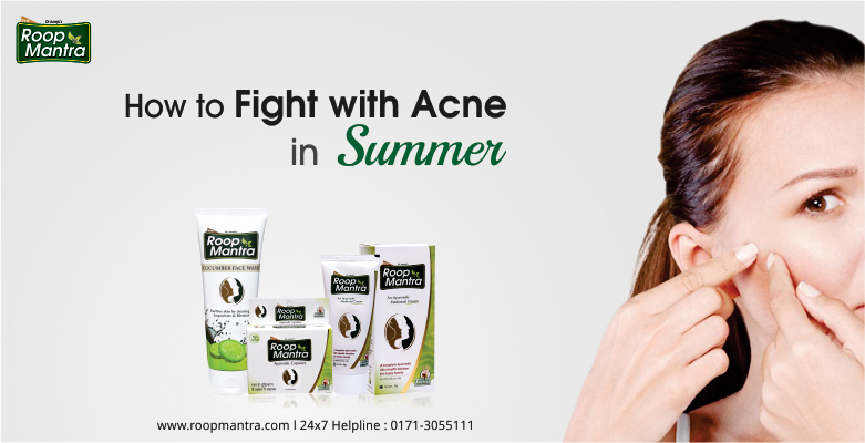 How to Fight With Acne In Summer - Roop Mantra