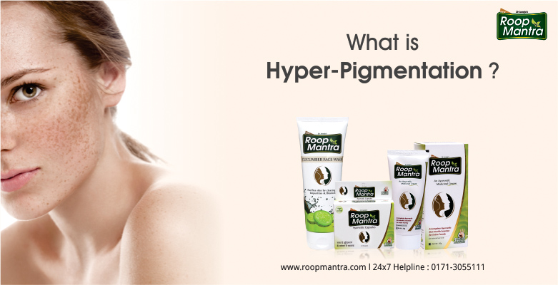 What-Is-Hyper-Pigmentation