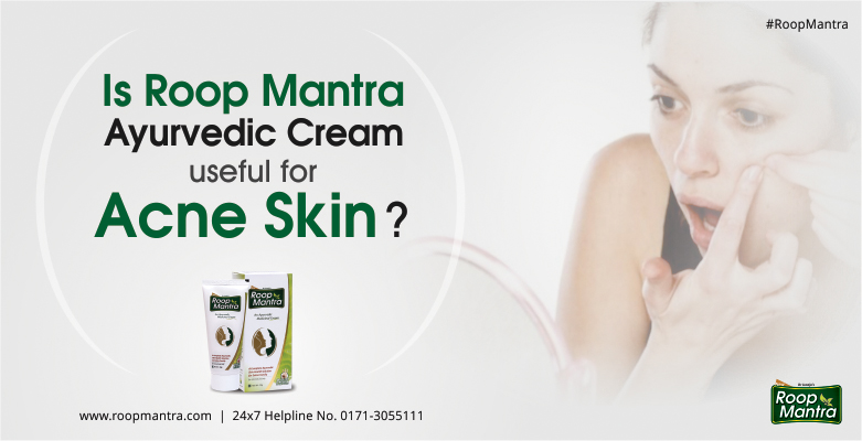 Is-Roop-Mantra-Ayurvedic-Cream-Useful-For-Acne-Skin