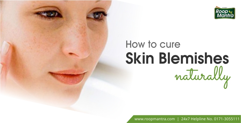How-to-cure-skin-blemishes-naturally