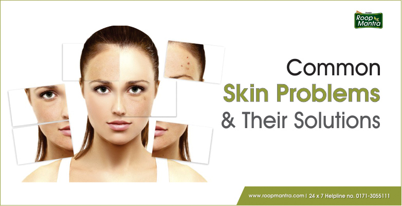 Common skin problems and their solutions
