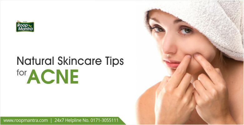 Natural-skincare-tips-for-Acne