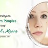 Say-Good-bye-to-Stubborn-Pimples-through-Natural-Means-blog