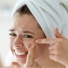 These-6-Habits-are-causing-Acne-to-your-Skin-roop-mantra-blog
