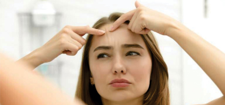 How-to-get-rid-of-Forehead-Acne-Find-your-answer-here