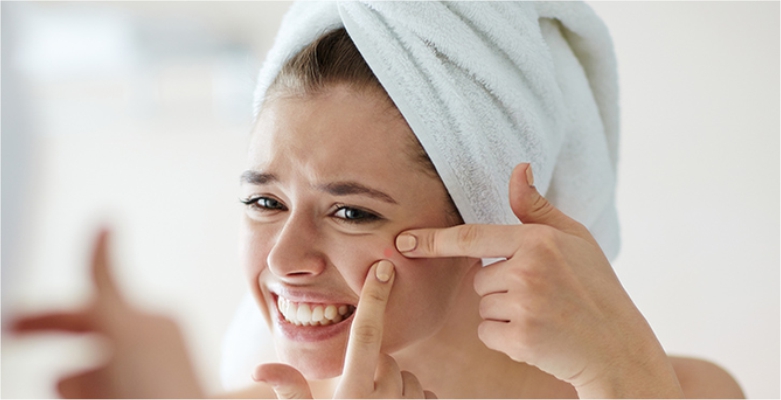 These-6-Habits-are-causing-Acne-to-your-Skin-roop-mantra-blog